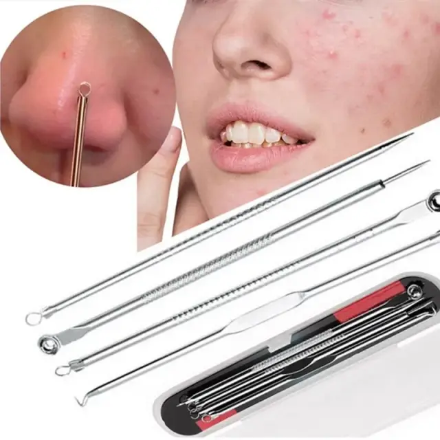 Blackhead Tweezers and Whitehead Remover Tool Spot Treatment Acne Set, Pimple Extractor Tool, ব্ল্যাকহেড টুইজার এবং হোয়াইটহেড রিমুভার টুল স্পট ট্রিটমেন্ট ব্রণ সেট, পিম্পল এক্সট্র্যাক্টর টুল