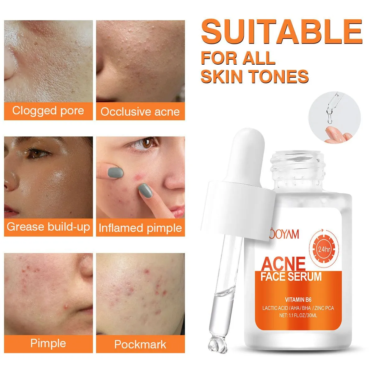 MOOYAM Acne Face Serum / ব্রণ কন্ট্রোল ফেস সিরাম 2