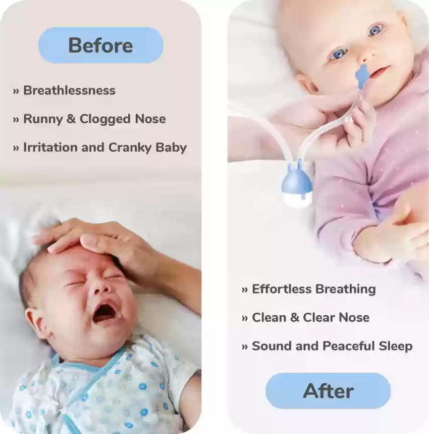 Baby Nose Cleaner, Nose Sucker Tool, Baby Nasal Aspirator Infant, Reusable Safe Nose Suction Newborn Health Care Baby Care Tools 2