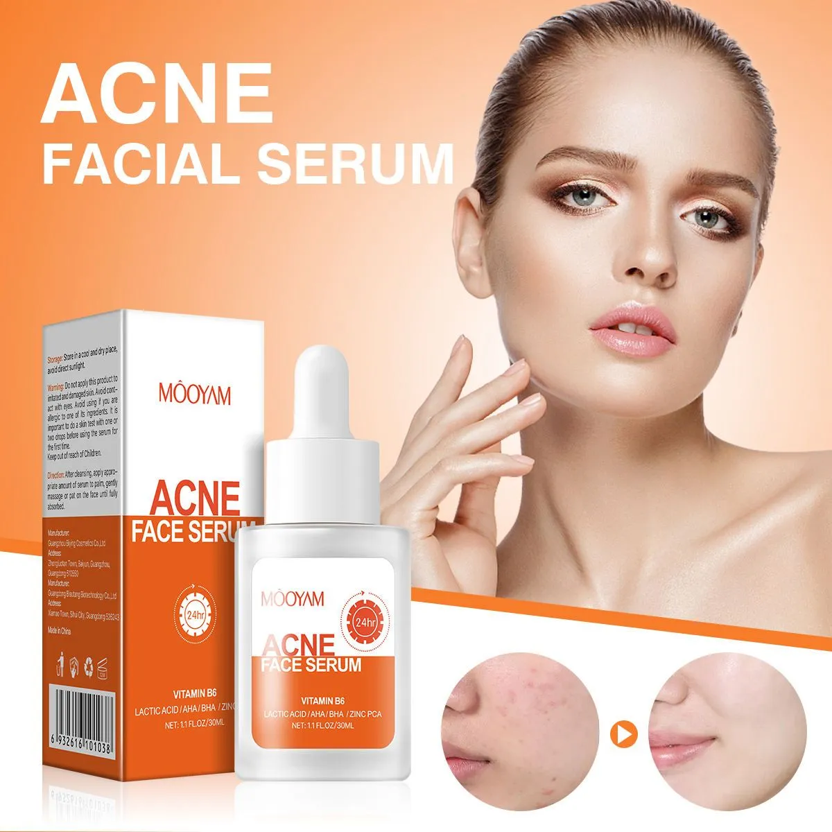 MOOYAM Acne Face Serum / ব্রণ কন্ট্রোল ফেস সিরাম